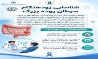 شناسایی زودهنگام سرطان روده بزرگ